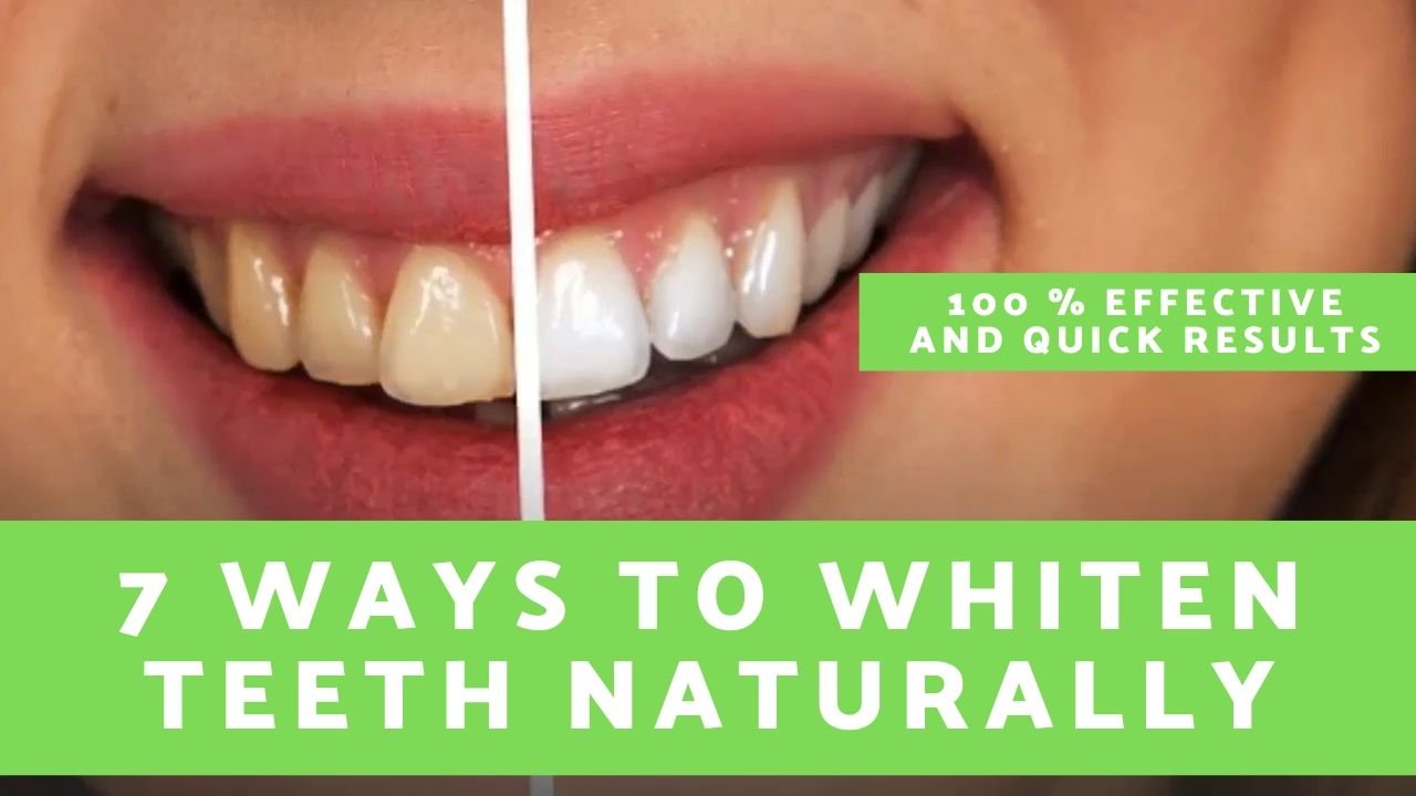 how to whiten teeth at home