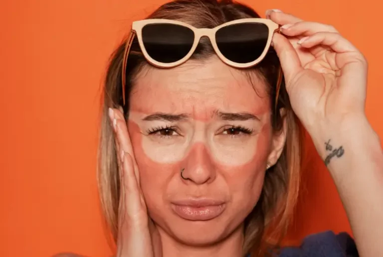 Woman worried about sunglasses tan lines around her eyes and nose