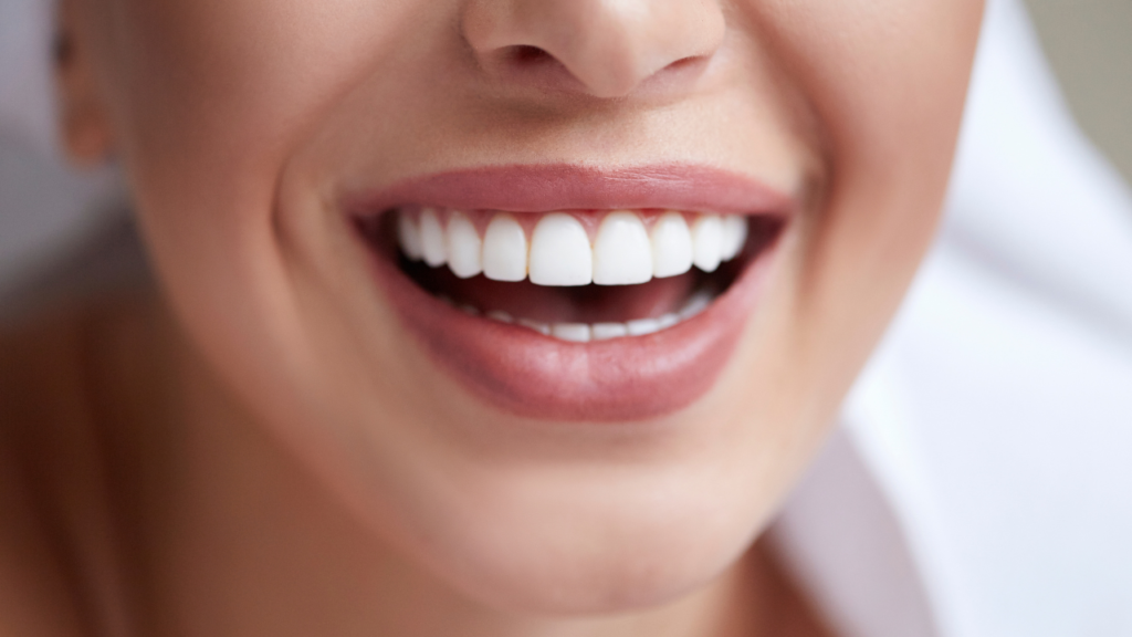 How to Whiten Teeth at Home in One Day