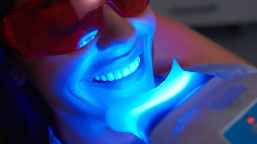 time required for zoom teeth whitening