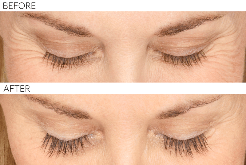  Tips for Growing Longer Eyelashes at Home