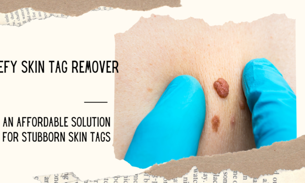 How Much Is Defy Skin Tag Remover in 2024?