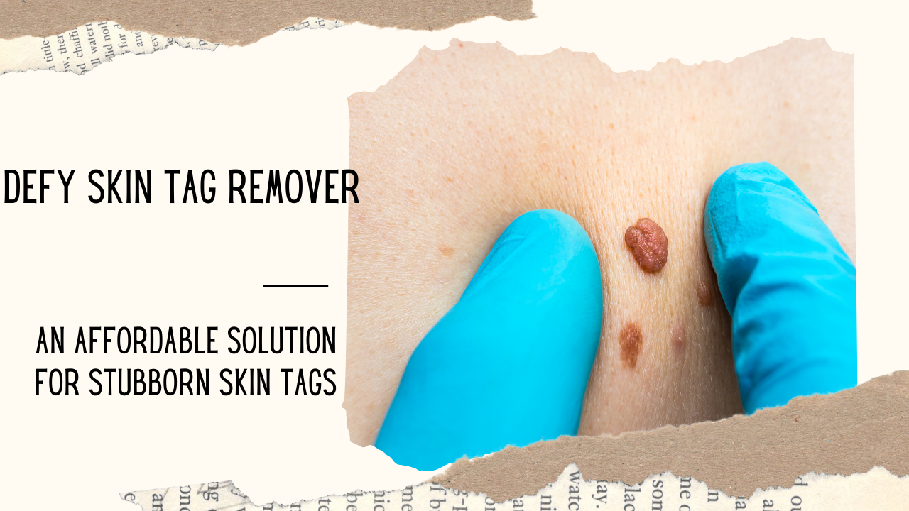 how much is defy skin tag remover?