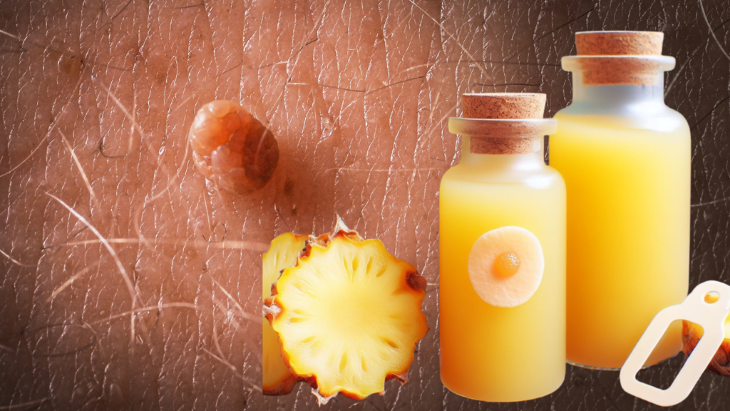 Does Pineapple Juice Remove Skin Tags
